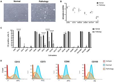 Metabolic Profile and Neurogenic Potential of Human Amniotic Fluid Stem Cells From Normal vs. Fetus-Affected Gestations